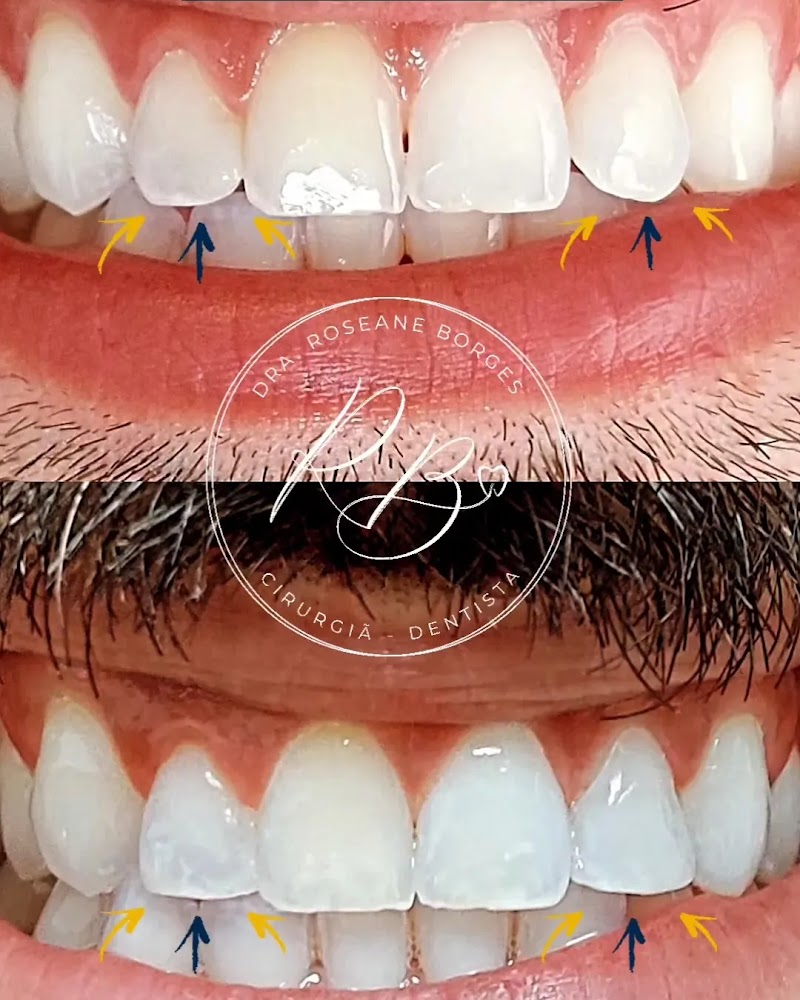 Dra. Roseane Borges Dentista