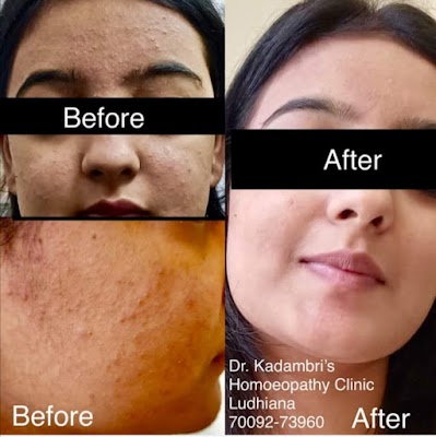 Dr Kadambri Homoeopathy Clinic /Best Homeopathic Doctor in ludhiana // Best Female/Gynae Doctor Ludhiana. - Image 3