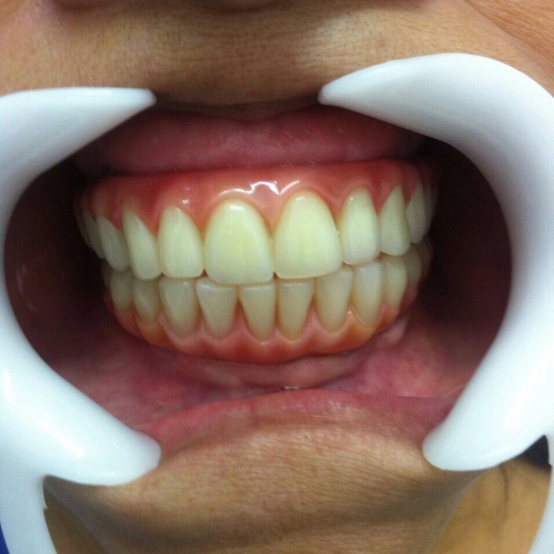 Projeto Implante- Dr. Leonardo Barroso - foto 3