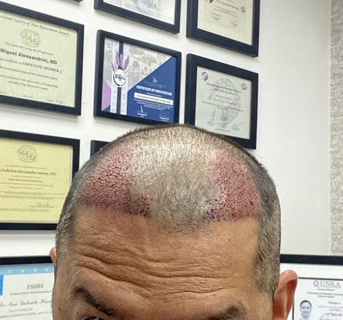 Neopel Hair Clinic logo