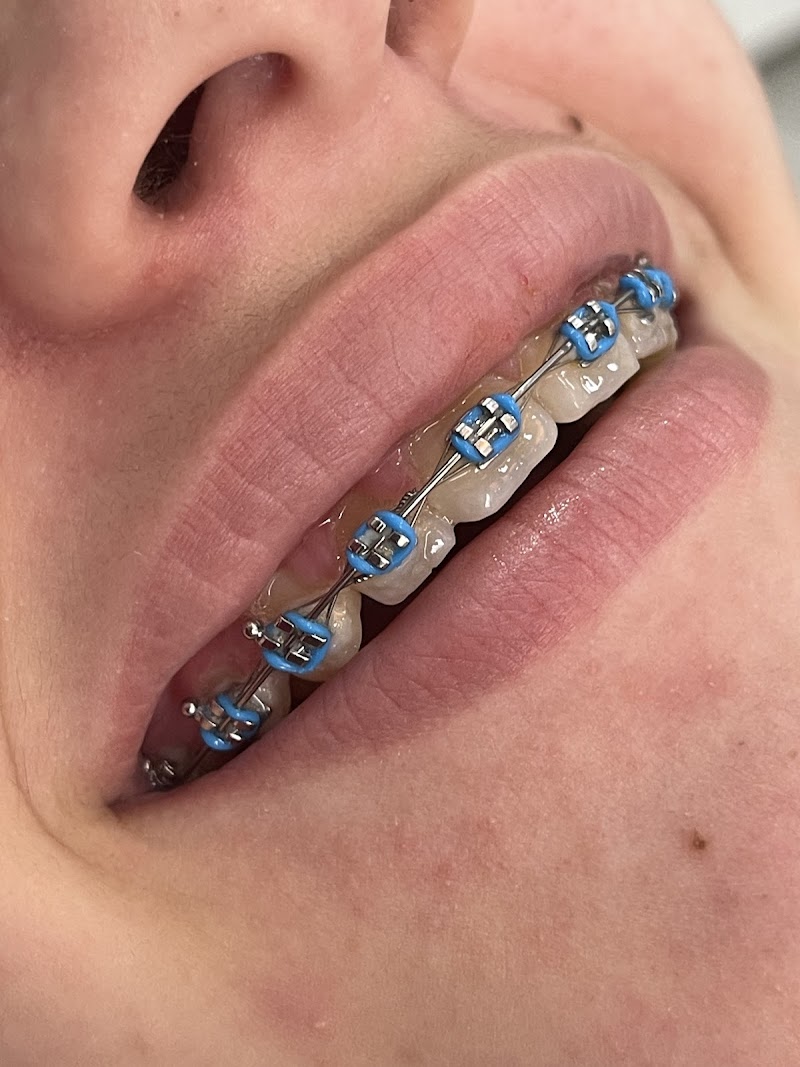 Implantes Dentários/ Proteses Dentárias/ Estética- Albarello Odontologia - Dra Adriana Albarello, Dentista - foto 2