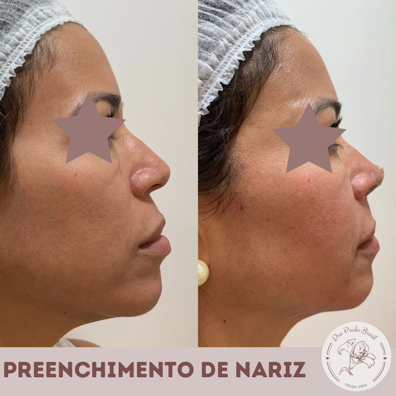 Dra Paula Brasil Harmonização Orofacial - foto 5