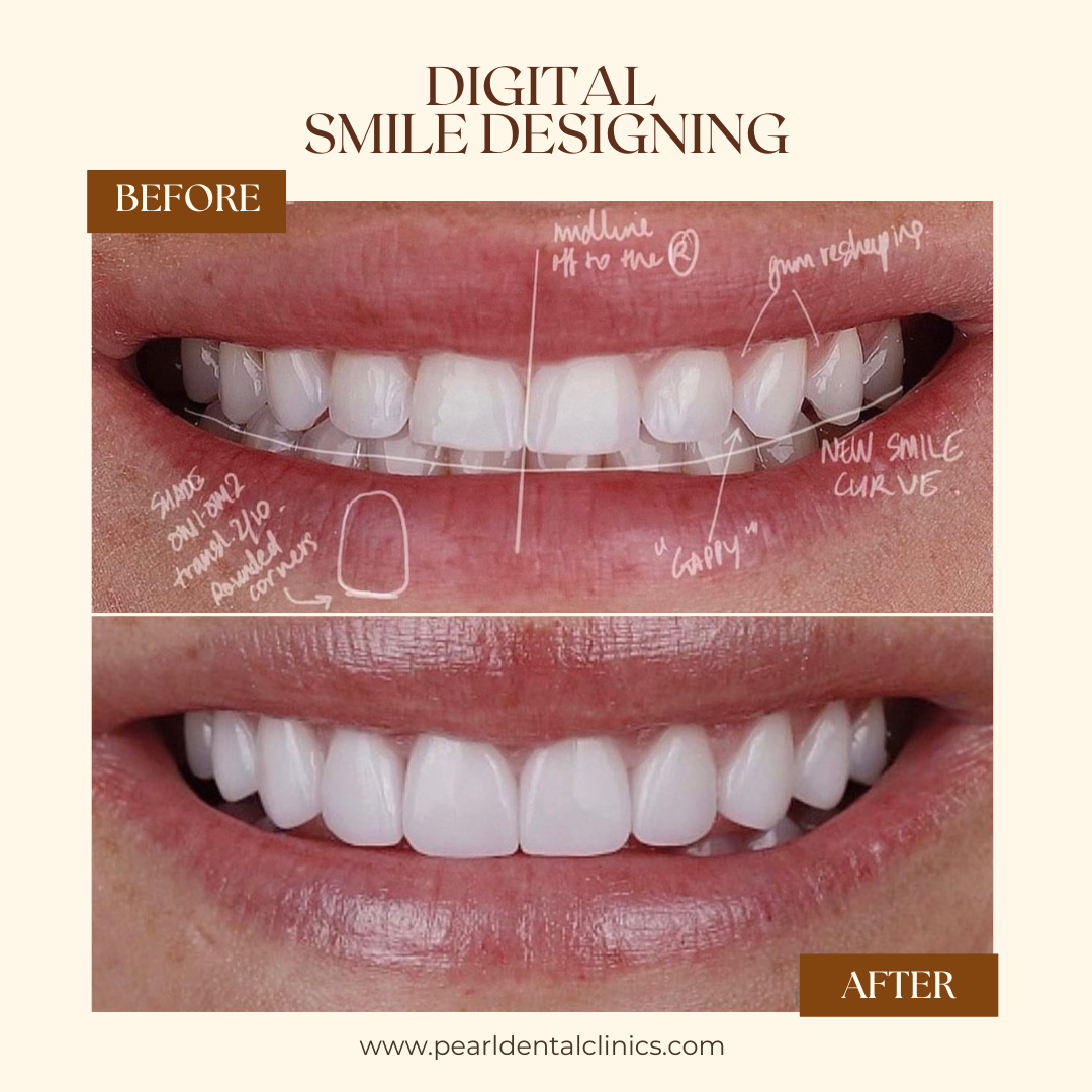 Pearl Dental Clinic - Business Bay 3