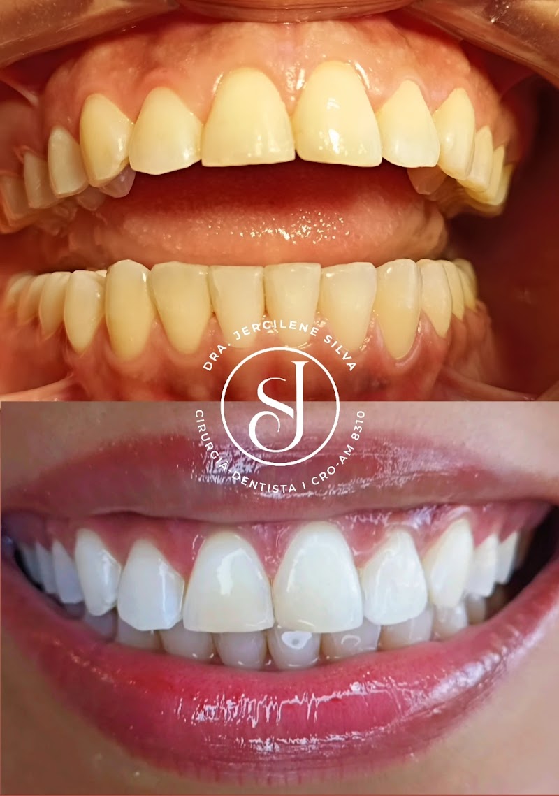 Dra. Jercilene Silva - Clínica Odontológica - foto 3