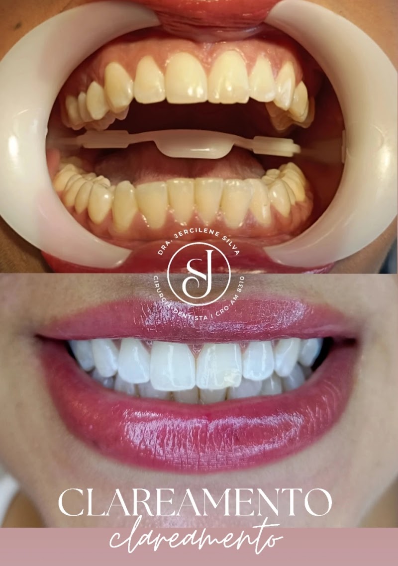 Dra. Jercilene Silva - Clínica Odontológica