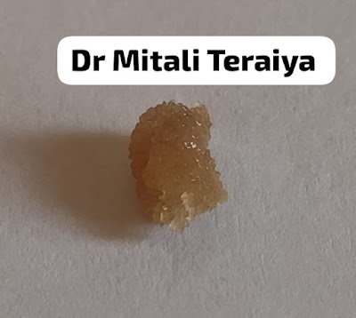 Dr. Mitali Teraiya MD Homeopathy - Image 3
