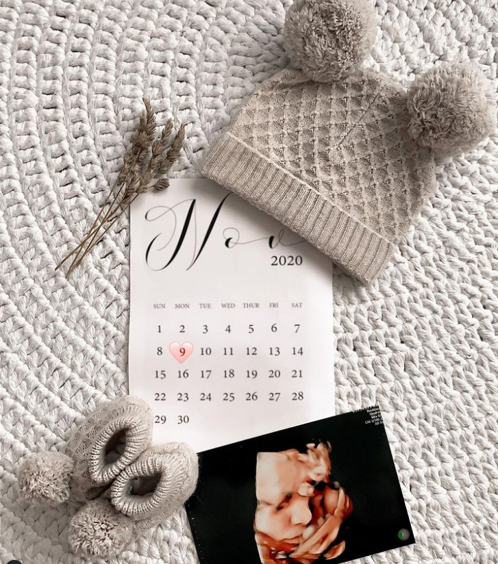 3D 4D Ultrasound Arizona