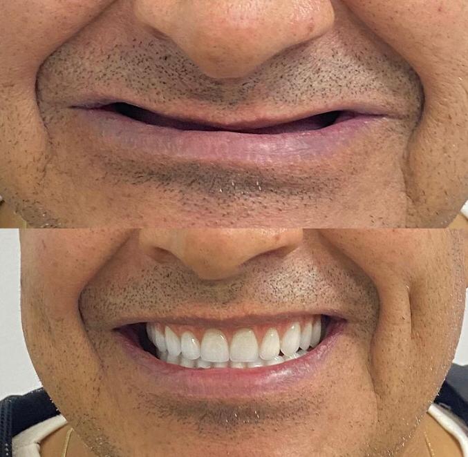 Oral Sin Implantes Curitiba - Santa Felicidade