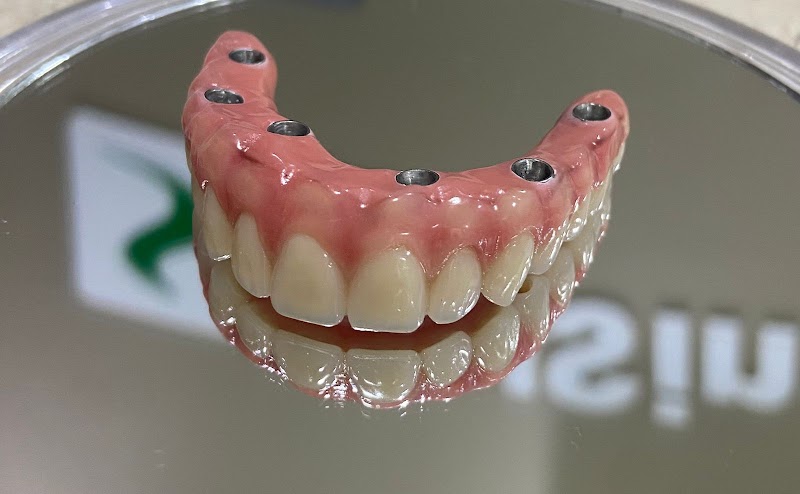 Oral Sin Implantes Curitiba - Santa Felicidade - foto 3