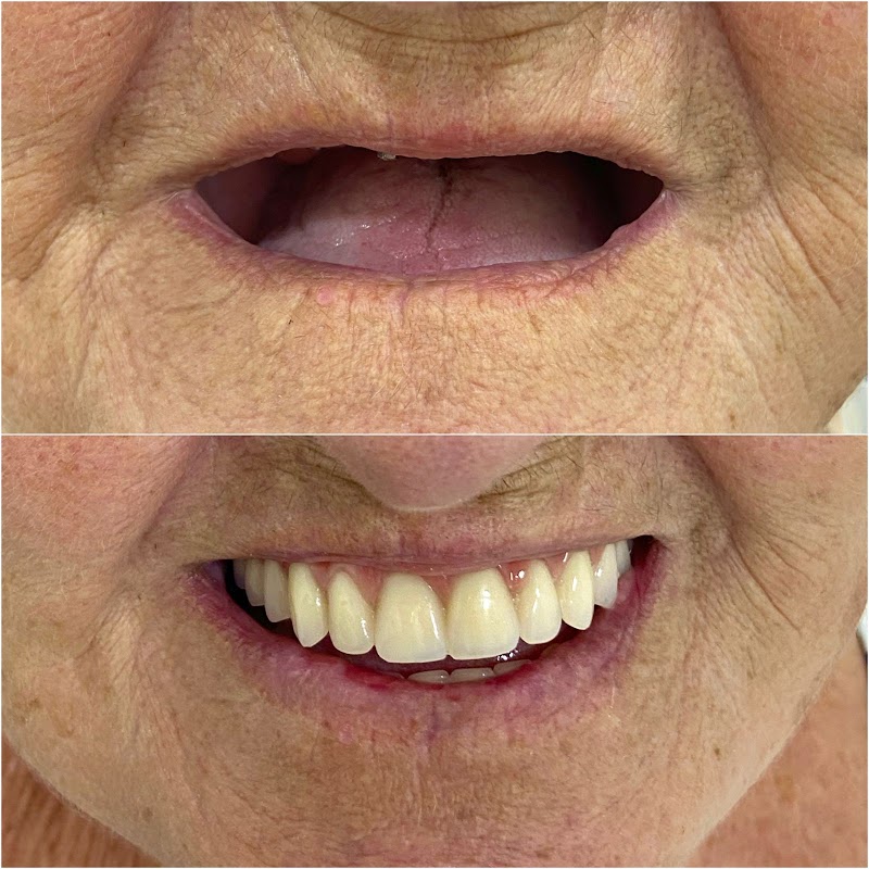 Oral Sin Implantes Curitiba - Santa Felicidade - foto 2