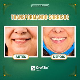 Oral Sin Implantes Curitiba - Santa Felicidade - foto 5