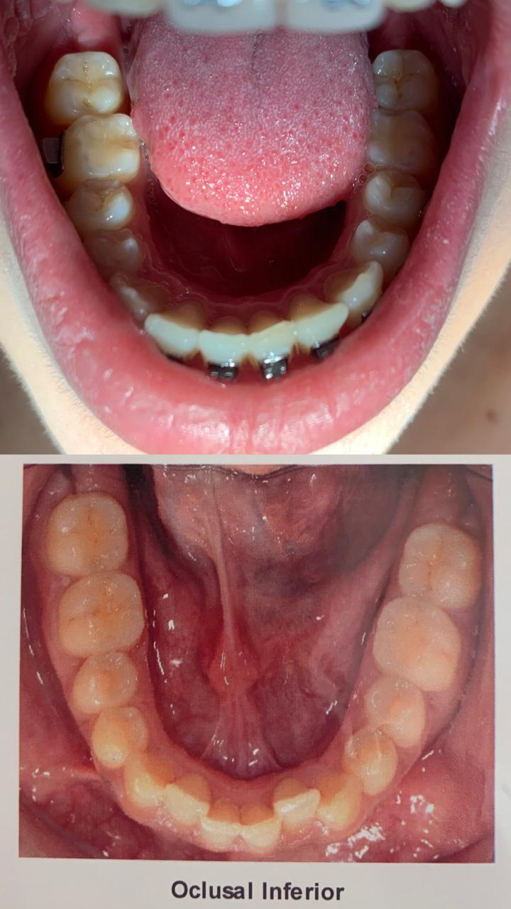 Clínica Dra Thalita Silva | Dentista em Rio das Pedras - foto 4