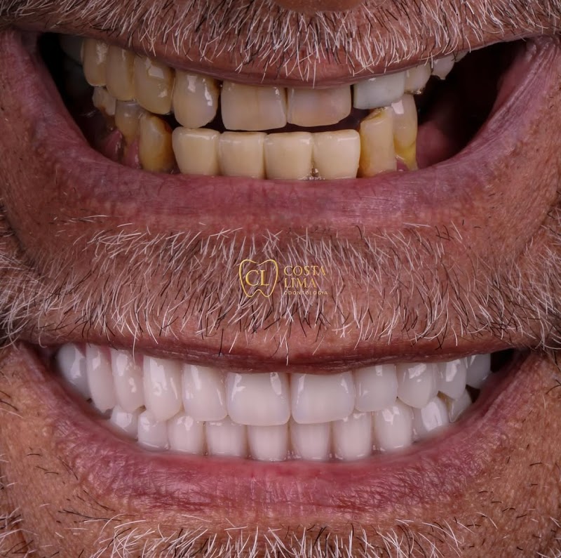 Costa Lima Odontologia | Dentista especialista em implante dentário em Madureira - foto 2
