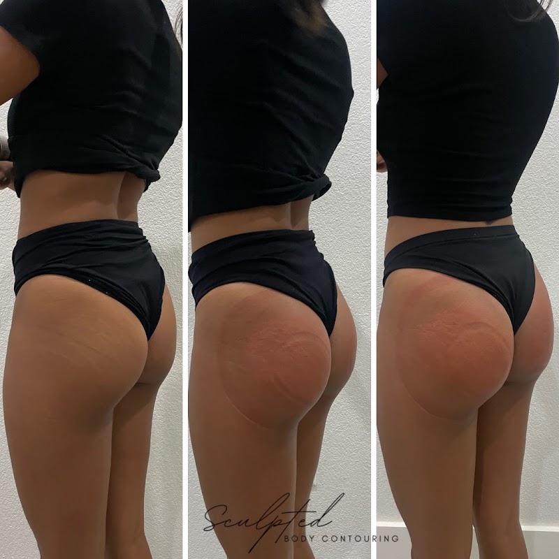 Body Sculpt Cayman photo 2