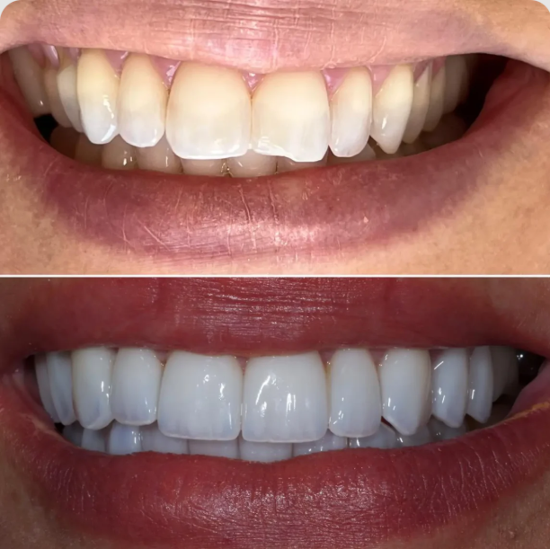 Dra Kaliane Bitencourt | Implante Dentário | Cirurgiã Dentista - foto 4