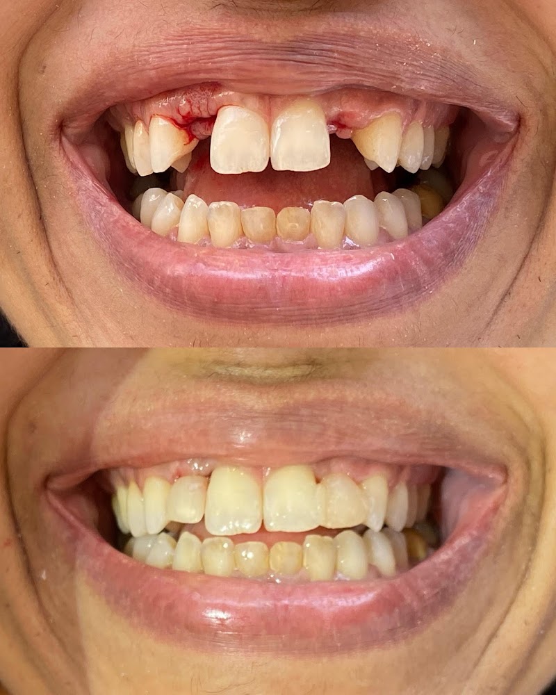 Dentista Belo Horizonte - Dra. Ana Caroline Alves - foto 5