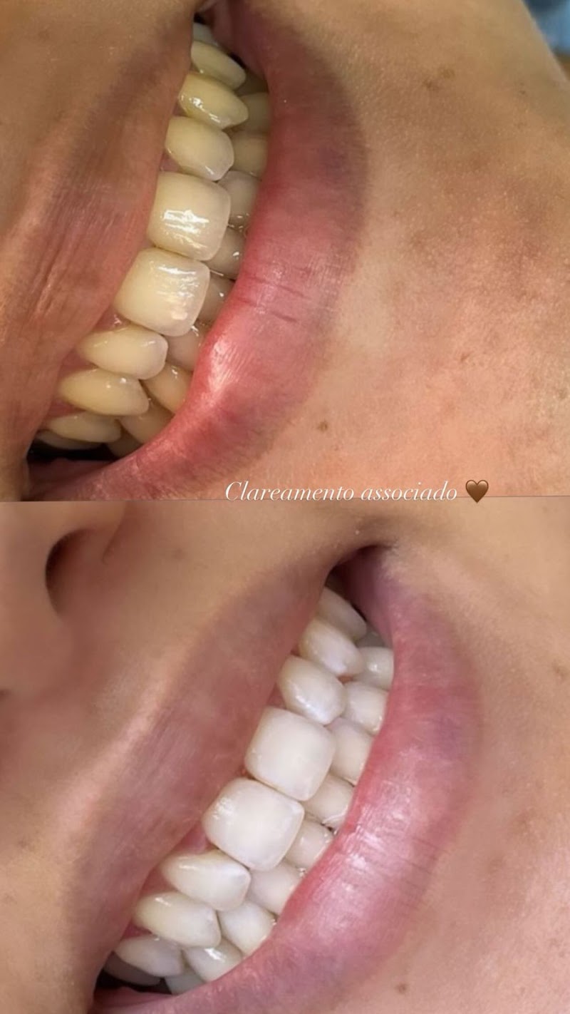 Dra. Sophia Goulart - Odontologia e Harmonização Facial - foto 5