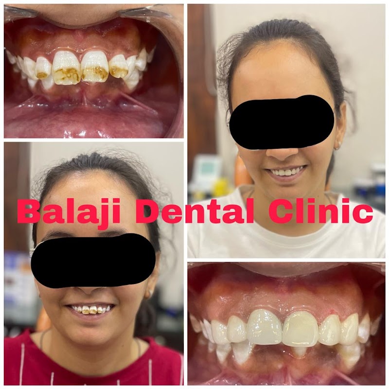 SHRI BALAJI DENTAL AND COSMETIC CLINIC | Dental Clinic | Dental Implant | Dentist Chitrakoot clinic