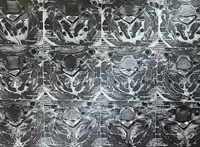 NeuGynesis:Neuro,Gynae & IVF Clinic(Brain,Spine & Stroke Surgeon-Dr Dinesh,MCh:Neuro-JIPMER, IVF-Dr Shobhna MD,MRCOG,FNB:IVF) - Image 2