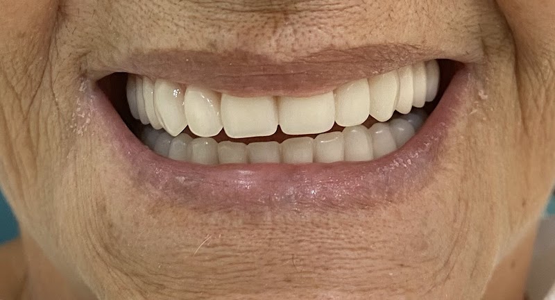 Implante e Prótese Dentária/ Dra Xênia Roberta