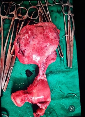 Dr Archana Bhardwaj MS GYNAE || Best Gynecologist in Bharatpur( स्त्री प्रसूति एवं निसंतानता रोग विशेषज्ञ) - Image 3