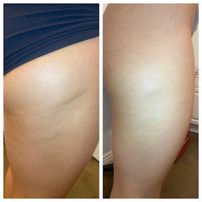 Mountain Muscle Medical Aesthetics photo 4