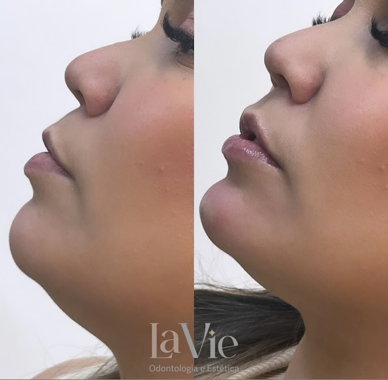 Dra. Caroline Alves | Dentista Endodontista - foto 4