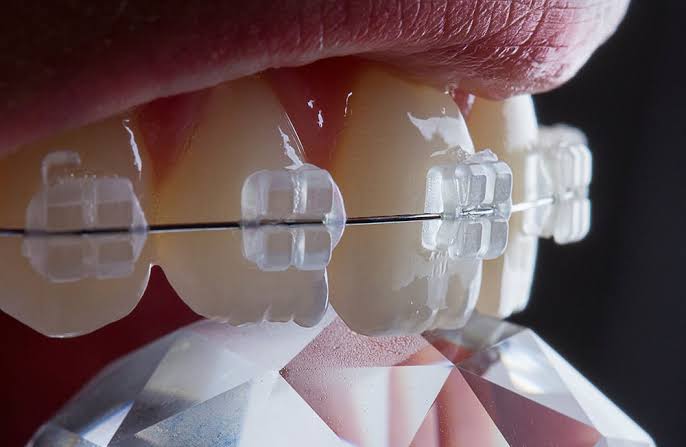 INSTITUTO MAIS SORRISO - Odontologia - foto 5