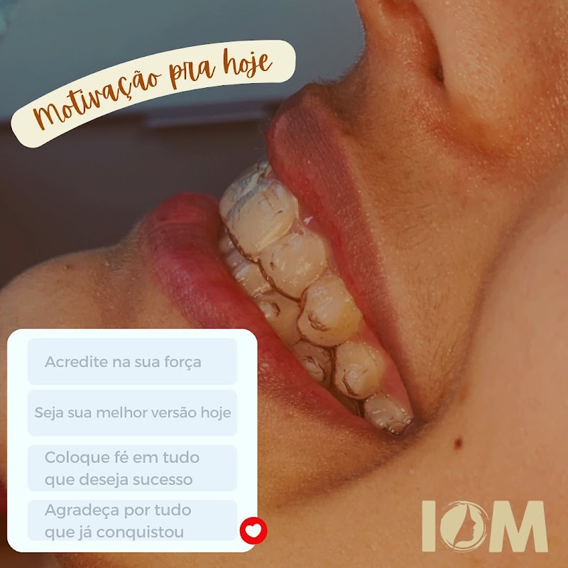 Instituto Orto Maxilofacial: Implantes, Invisalign, Recife PE - foto 3