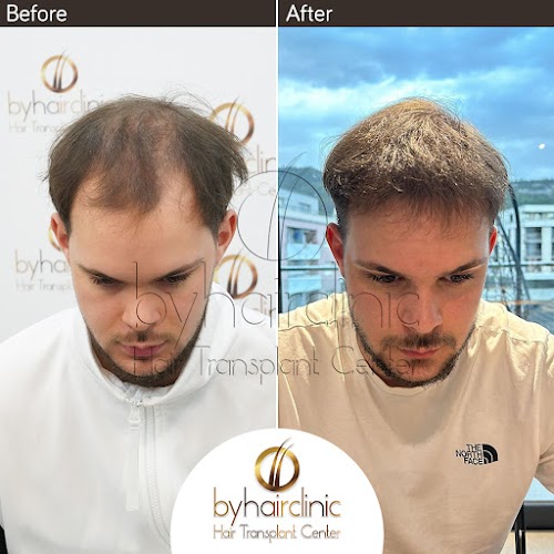 Byhairclinic | Hair Transplant Center logo
