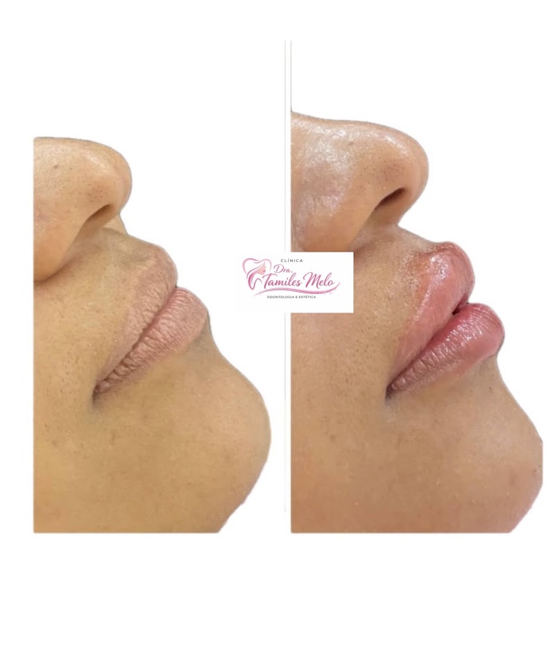 Drª.Tamiles Melo Odontologia e Estética - foto 2