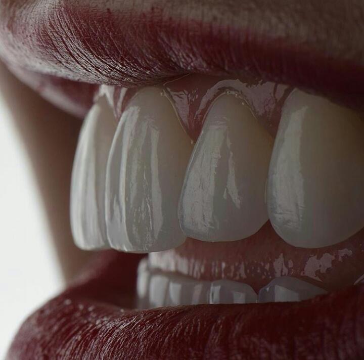 Dra Sabrina Wigneron. Especialista/Mestre Implante Dentário. Especialista em Protése Dentária - foto 4