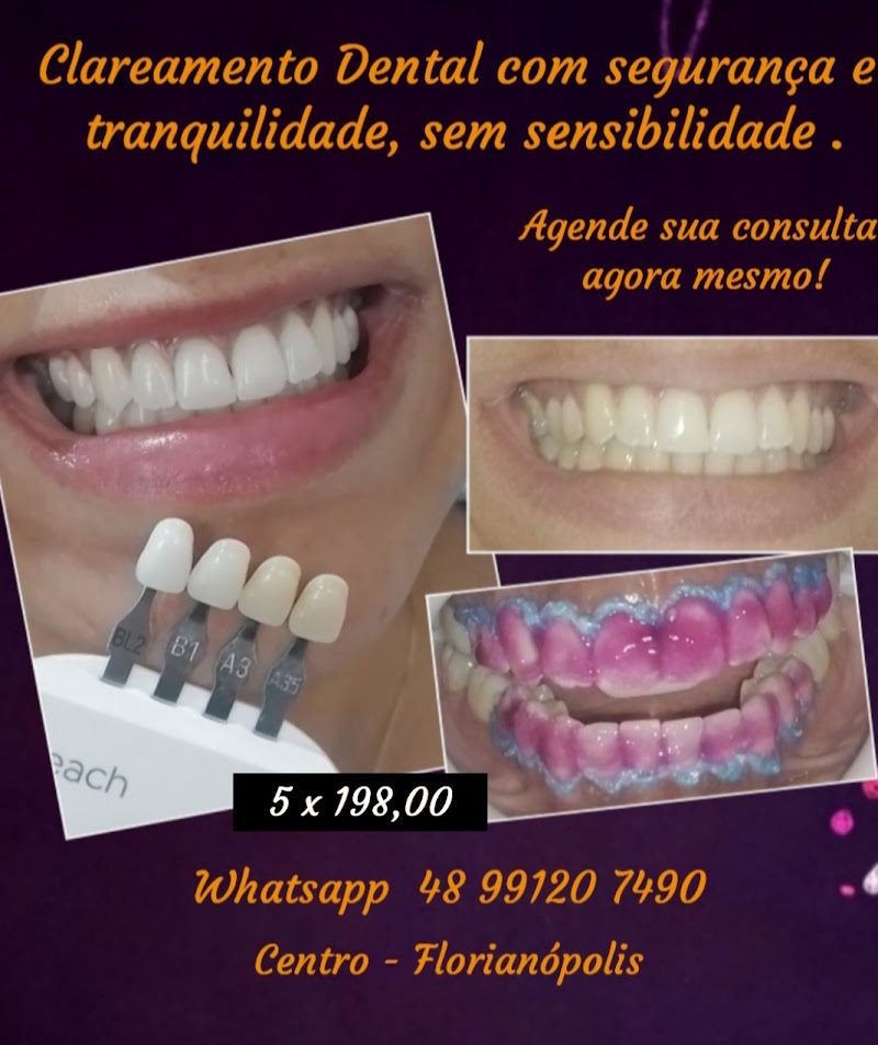 Clareamento Dental & Facetas