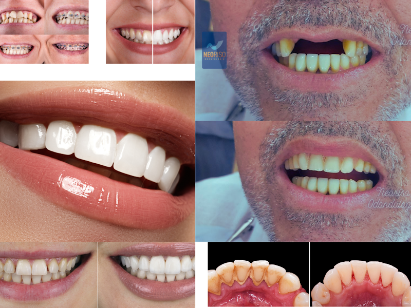 Neoriso Odontologia - Dentistas Especializados em Implantes Dentários em Duque De Caxias. - foto 3