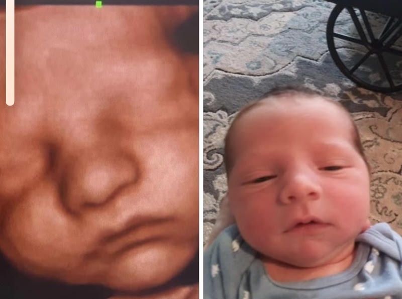 WR 3D/4D/5D ultrasound maternity & newborn photography