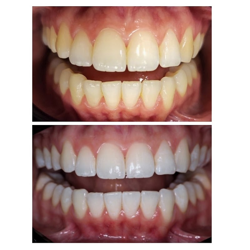 Dra. Ananda Bahia Clareamento Dental - foto 2