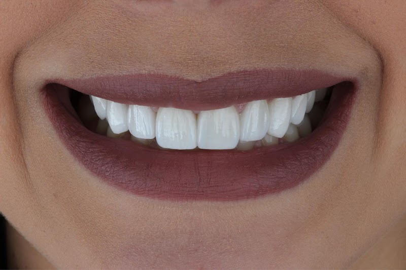 DENTISTA MÉIER - foto 5