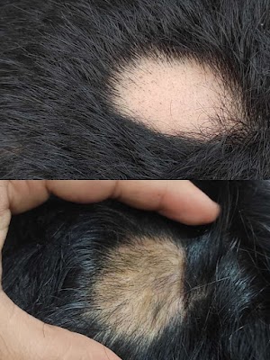 Al siraj skin# and hair#clinic