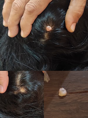 Al siraj skin# and hair#clinic - Image 3