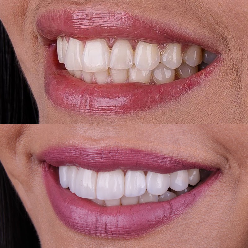 IRio Odontologia - Clínica Odontológica na Barra da Tijuca