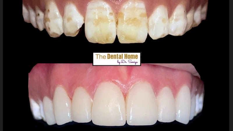 THE DENTAL HOME By DR. SONIYA