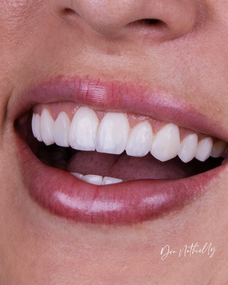 Dra. Nathielly Leite Odontologia