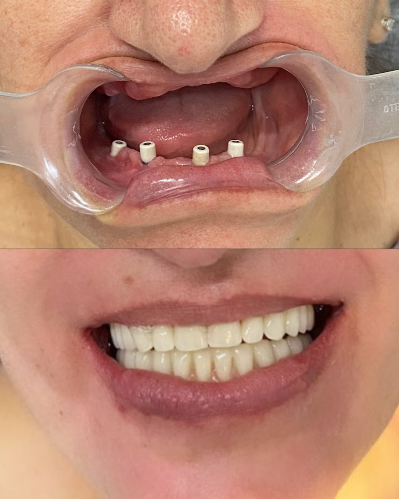 Dr. Ibrahim Jamil | Implantes Dentários e Harmonização Facial | Centro de Florianópolis - foto 3