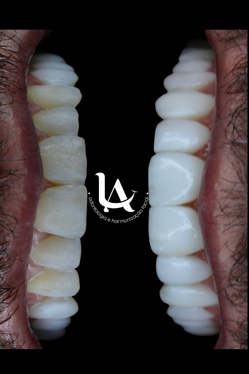 LA Odontologia e Implantodontia - Campo Grande, Implantes Dentários, Lentes Dentais, Invisalign, Urgência Dentista - foto 2