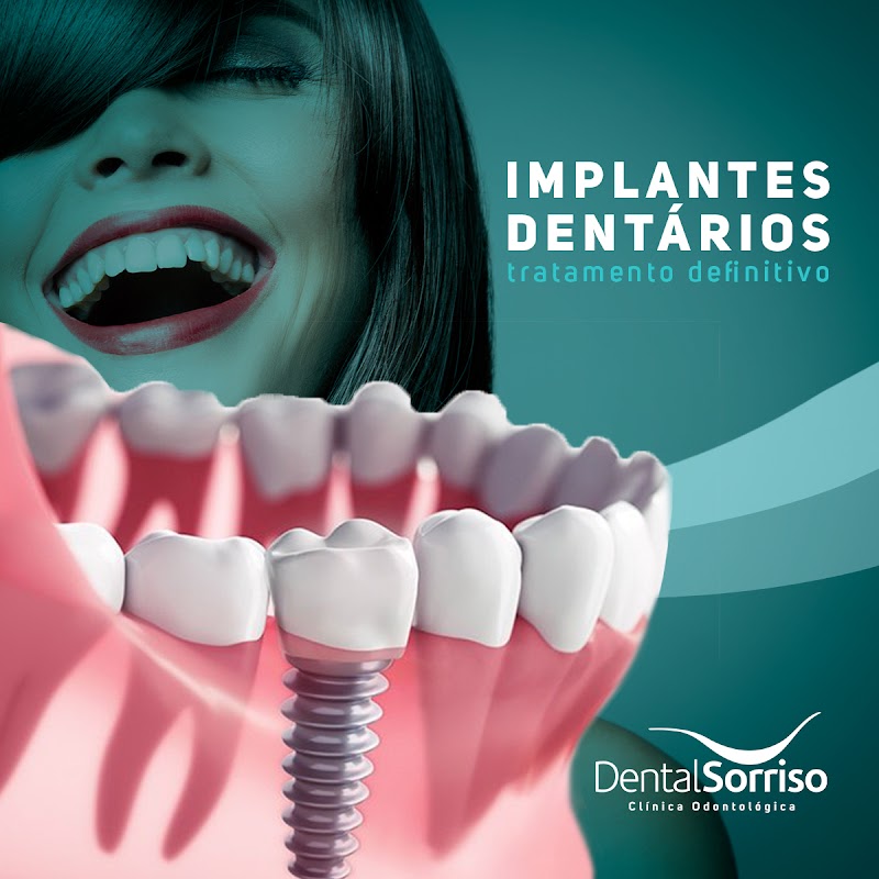 Dental Implantes Slz - Odontologia Especializada - foto 4