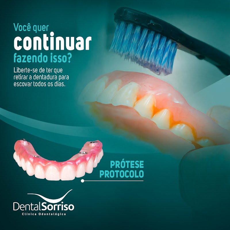 Dental Implantes Slz - Odontologia Especializada - foto 5