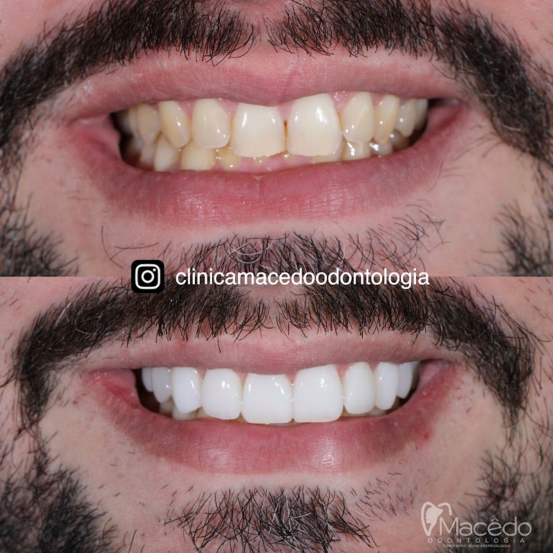 Clínica Macêdo odontologia Belém - foto 4
