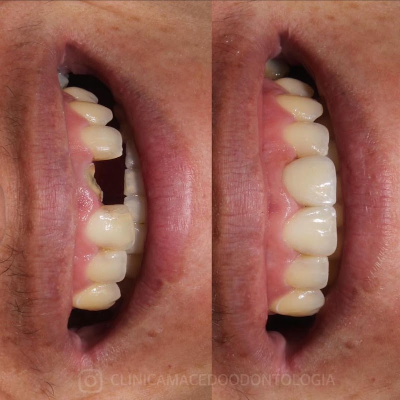 Clínica Macêdo odontologia Belém - foto 2