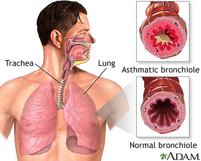 Dr Biswajit Bhuyan MD (Pulmonary medicine)