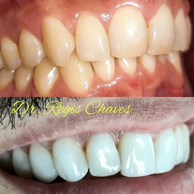 Dentista Dr. Regis | Clínica Odontológica Odonto Chaves - foto 4